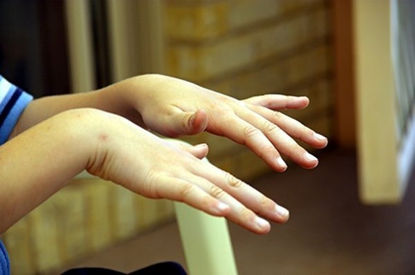 За децу која имају организационих проблема, вежбе за руке могу бити најбољи приступ.