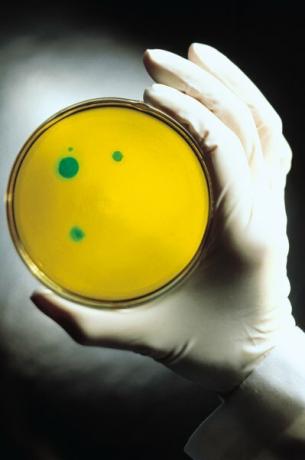 Käsineiden käyttö agar-levyjä käsiteltäessä estää bakteereja käsistäsi saastuttamasta näytettä.